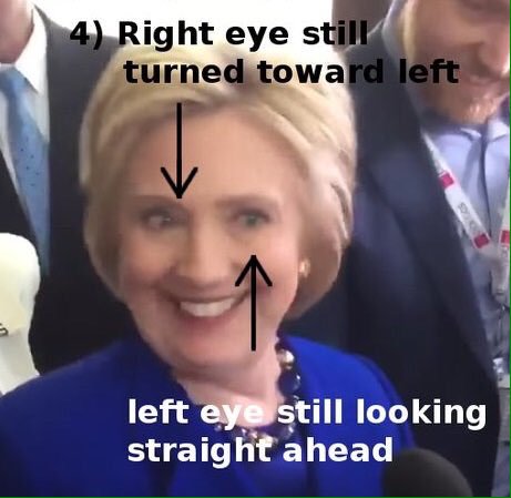 crosseyedHillary1