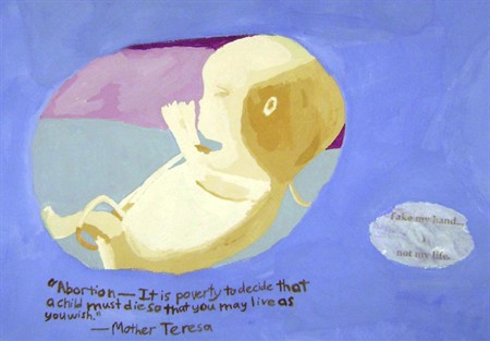 Abortion provider says fetal remains should be sent home with the patient in a ‘gift bag’