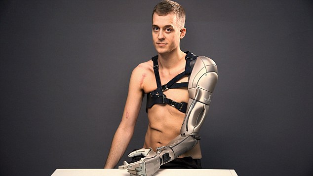 26-year old London man shares his bionic arm with the world, high tech limb dons its own phone charger and drone!
