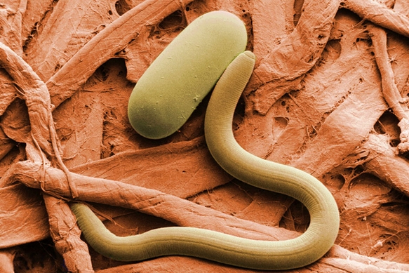 After prescribing painkillers for months, clueless doctors find 150 parasitic worms in woman’s stomach