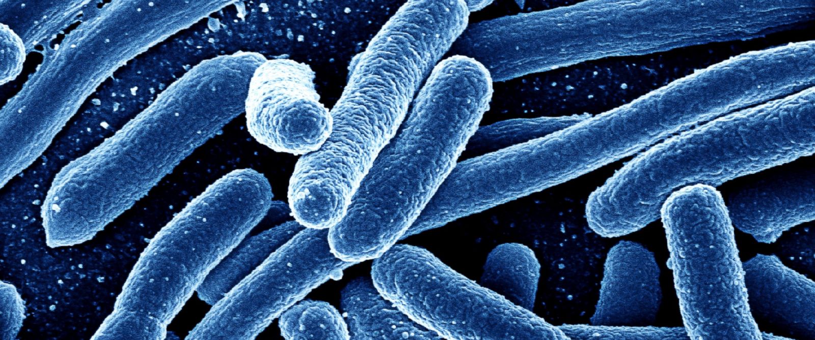 Deadly new strain of antibiotic-resistant yeast infection set to invade U.S.