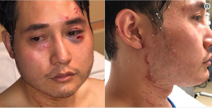 SoundCloud goes all-in for Antifa by permanently banning Andy Ngo, who routinely exposes Antifa’s violence and criminal behavior
