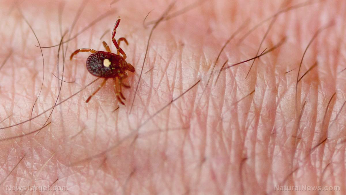 Alpha-gal Syndrome: Tick bites make millions of Americans allergic to red meat