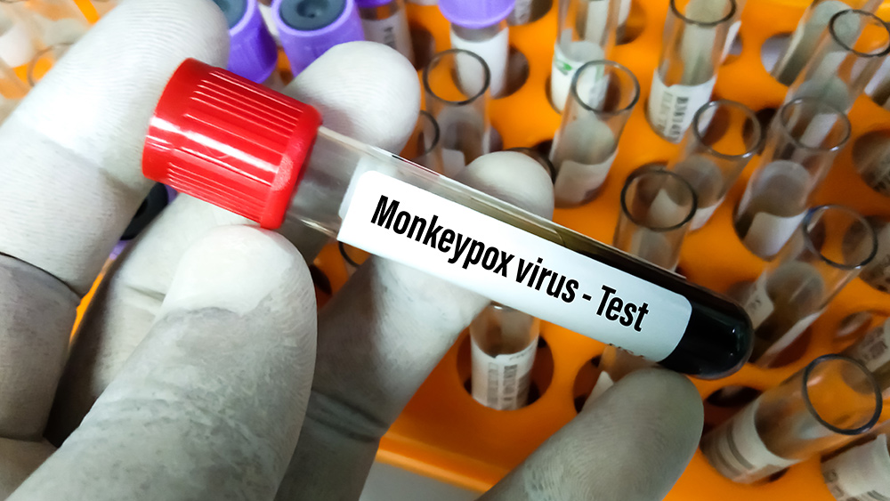 WHO: Monkeypox outbreak traced to homosexual men who attended rave events in Europe