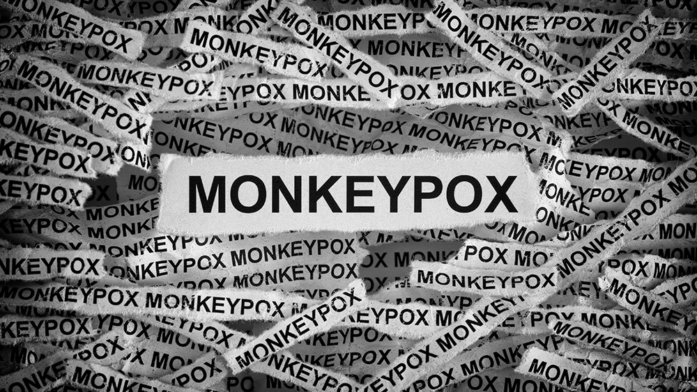 Dr. Robert Malone blasts mainstream media for spreading lies about monkeypox